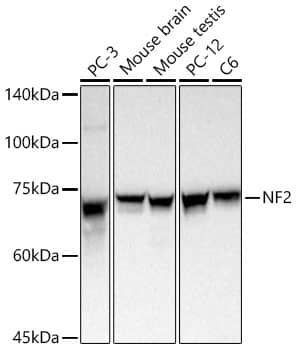 Western Blot: NF2/Merlin Antibody - BSA Free [NF2/Merlin] - Western blot analysis of various lysates using [KD Validated] NF2/Merlin Rabbit pAb  at 1:1000 dilution incubated overnight at 4C.Secondary antibody: HRP-conjugated Goat anti-Rabbit IgG (H+L) at 1:10000 dilution. Lysates/proteins: 25 ug per lane.Blocking buffer: 3% nonfat dry milk in TBST.Detection: ECL Basic Kit Exposure time: 30 s.