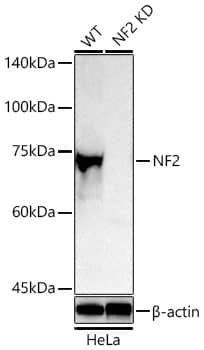 <b>Genetic Strategies Validation. </b>Western Blot: NF2/Merlin Antibody - BSA Free [NF2/Merlin] - Western blot analysis of lysates from wild type (WT) and NF2/Merlin knockdown (KD) HeLa cells using [KD Validated] NF2/Merlin Rabbit pAb  at 1:1000 dilution incubated overnight at 4C.Secondary antibody: HRP-conjugated Goat anti-Rabbit IgG (H+L) at 1:10000 dilution. Lysates/proteins: 25 ug per lane.Blocking buffer: 3% nonfat dry milk in TBST.Detection: ECL Basic Kit Exposure time: 180 s.