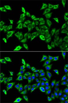 Immunocytochemistry/ Immunofluorescence: HADHA Antibody - BSA Free [NBP3-03743] - Immunofluorescence analysis of A-549 cells using [KO Validated] HADHA Rabbit pAb (A5346). Secondary antibody: Cy3-conjugated Goat anti-Rabbit IgG (H+L) (AS007) at 1:500 dilution. Blue: DAPI for nuclear staining.