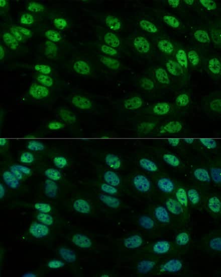 Immunocytochemistry/ Immunofluorescence: hnRNP M Antibody - Azide and BSA Free [hnRNP M] - Immunofluorescence analysis of C6 cells using hnRNP M Rabbit pAb  at dilution of 1:100. Secondary antibody: Cy3-conjugated Goat anti-Rabbit IgG (H+L)  at 1:500 dilution. Blue: DAPI for nuclear staining.