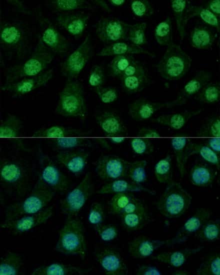 Immunocytochemistry/ Immunofluorescence: hnRNP M Antibody - Azide and BSA Free [hnRNP M] - Immunofluorescence analysis of L929 cells using hnRNP M Rabbit pAb  at dilution of 1:100. Secondary antibody: Cy3-conjugated Goat anti-Rabbit IgG (H+L)  at 1:500 dilution. Blue: DAPI for nuclear staining.