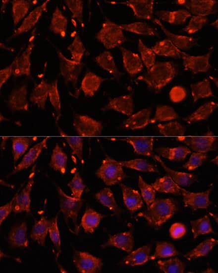 Immunocytochemistry/ Immunofluorescence Intersectin 2 Antibody - Azide and BSA Free