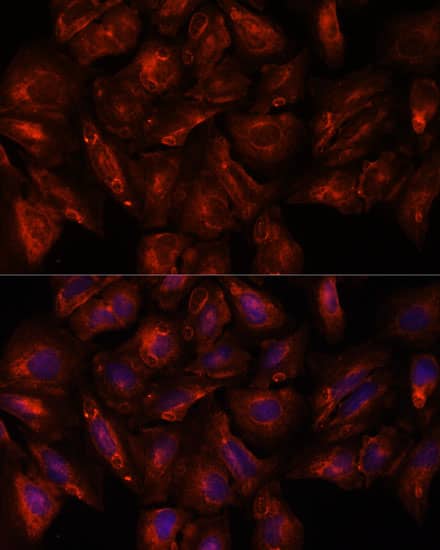 Immunocytochemistry/ Immunofluorescence: Intersectin 2 Antibody - Azide and BSA Free [NBP3-03747] - Immunofluorescence analysis of U-2 OS cells using Intersectin 2 Rabbit pAb (A16525) at dilution of 1:100. Secondary antibody: Cy3 Goat Anti-Rabbit IgG (H+L) (AS007) at 1:500 dilution. Blue: DAPI for nuclear staining.