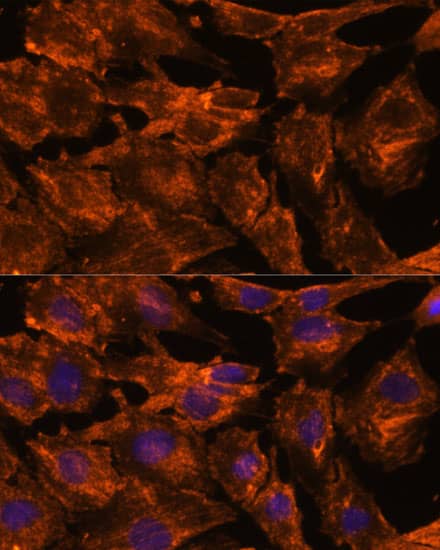 Immunocytochemistry/ Immunofluorescence: Intersectin 2 Antibody - Azide and BSA Free [NBP3-03747] - Immunofluorescence analysis of C6 cells using Intersectin 2 Rabbit pAb (A16525) at dilution of 1:100. Secondary antibody: Cy3 Goat Anti-Rabbit IgG (H+L) (AS007) at 1:500 dilution. Blue: DAPI for nuclear staining.