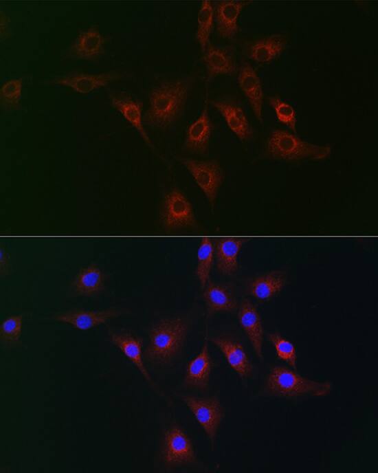 Immunocytochemistry/ Immunofluorescence: gp130/CD130 Antibody - Azide and BSA Free [NBP3-03789] - Immunofluorescence analysis of NIH/3T3 cells using gp130/CD130 Rabbit pAb (A18036) at dilution of 1:100 (40x lens). Secondary antibody: Cy3 Goat Anti-Rabbit IgG (H+L) (AS007) at 1:500 dilution. Blue: DAPI for nuclear staining.