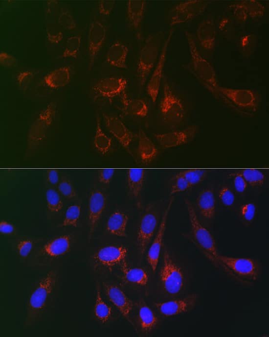 Immunocytochemistry/ Immunofluorescence: gp130/CD130 Antibody - Azide and BSA Free [NBP3-03789] - Immunofluorescence analysis of U2OS cells using gp130/CD130 Rabbit pAb (A18036) at dilution of 1:100 (40x lens). Secondary antibody: Cy3 Goat Anti-Rabbit IgG (H+L) (AS007) at 1:500 dilution. Blue: DAPI for nuclear staining.
