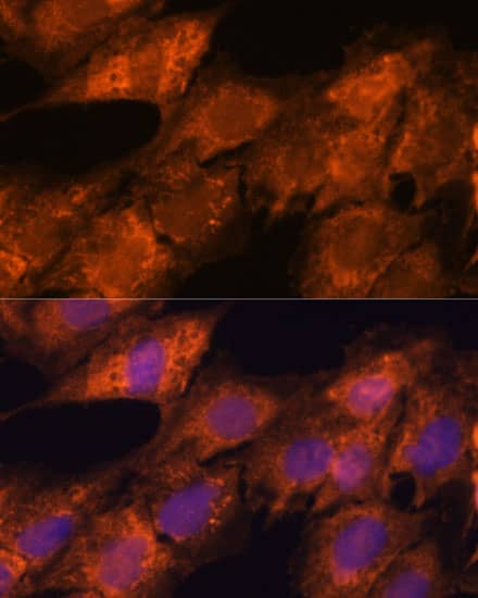 Immunocytochemistry/ Immunofluorescence: Importin4 Antibody - Azide and BSA Free [NBP3-03794] - Immunofluorescence analysis of C6 cells using Importin4 Rabbit pAb (A15600) at dilution of 1:100. Secondary antibody: Cy3 Goat Anti-Rabbit IgG (H+L) (AS007) at 1:500 dilution. Blue: DAPI for nuclear staining.