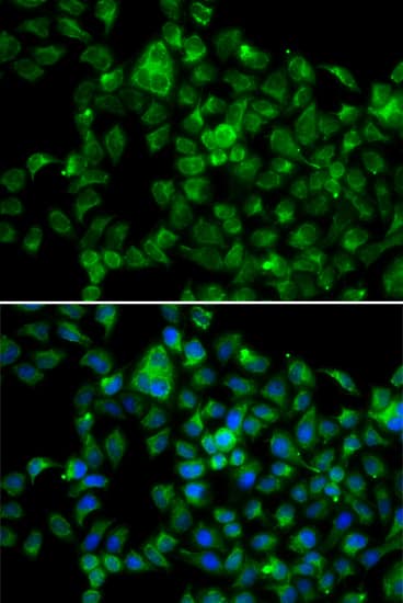 Immunocytochemistry/ Immunofluorescence CML2 Antibody - BSA Free