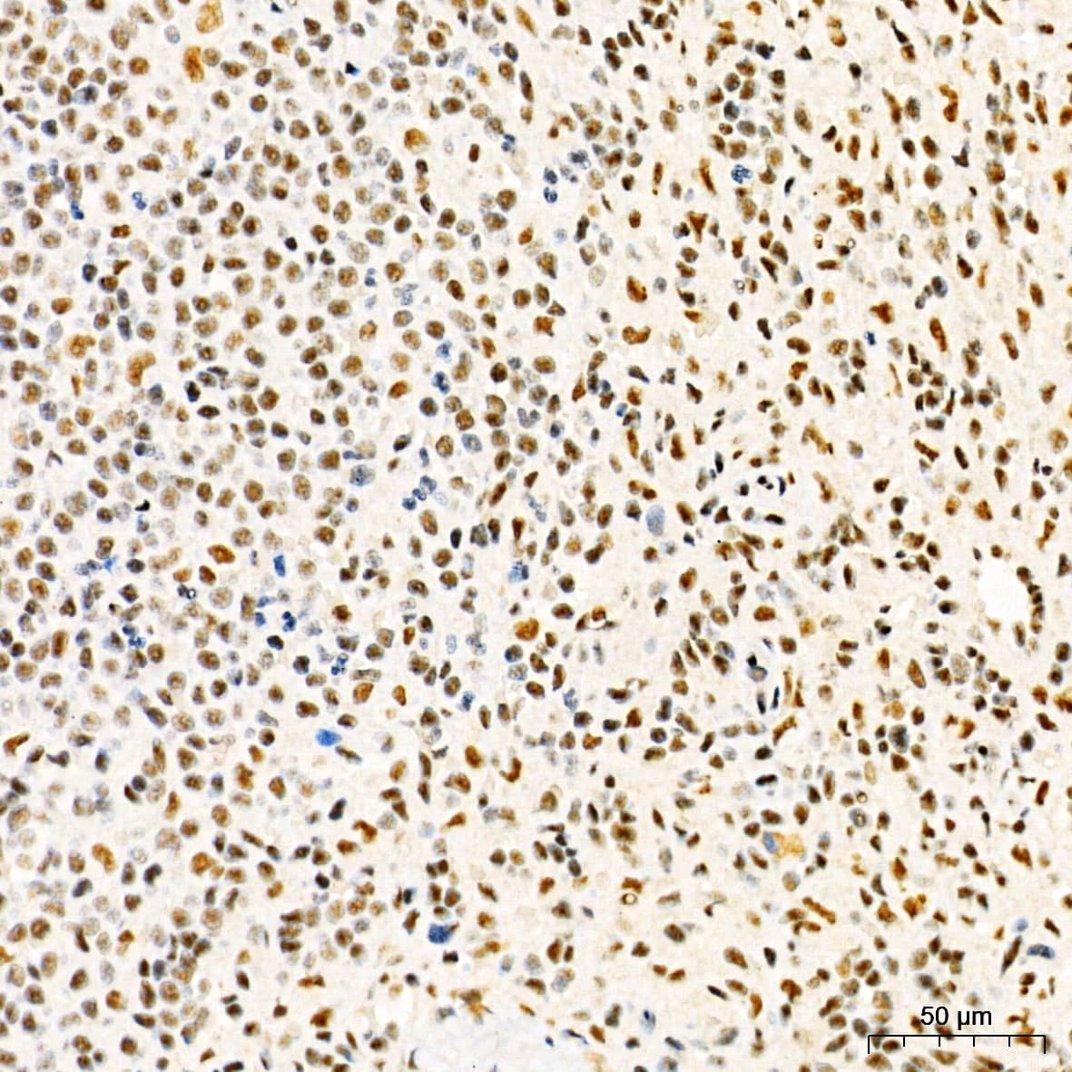 Immunohistochemistry: HYPB Antibody - Azide and BSA Free [HYPB] - Immunohistochemistry analysis of paraffin-embedded Human spleen tissue using HYPB Rabbit pAb  at a dilution of 1:1000 (40x lens). High pressure antigen retrieval performed with 0.01M Citrate Buffer (pH 6.0) prior to IHC staining.