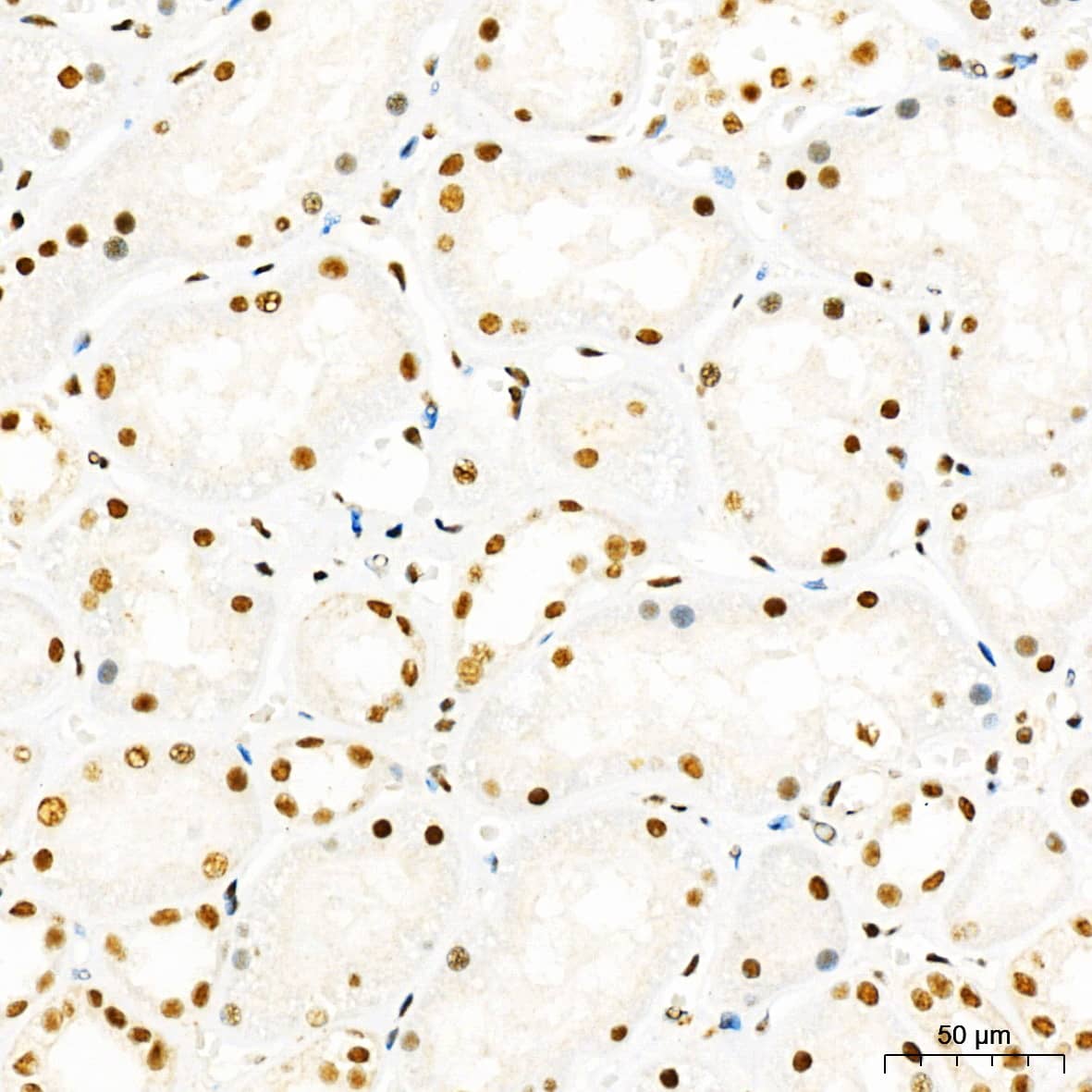 Immunohistochemistry: HYPB Antibody - Azide and BSA Free [HYPB] - Immunohistochemistry analysis of paraffin-embedded Human kidney tissue using HYPB Rabbit pAb  at a dilution of 1:1000 (40x lens). High pressure antigen retrieval performed with 0.01M Citrate Buffer (pH 6.0) prior to IHC staining.