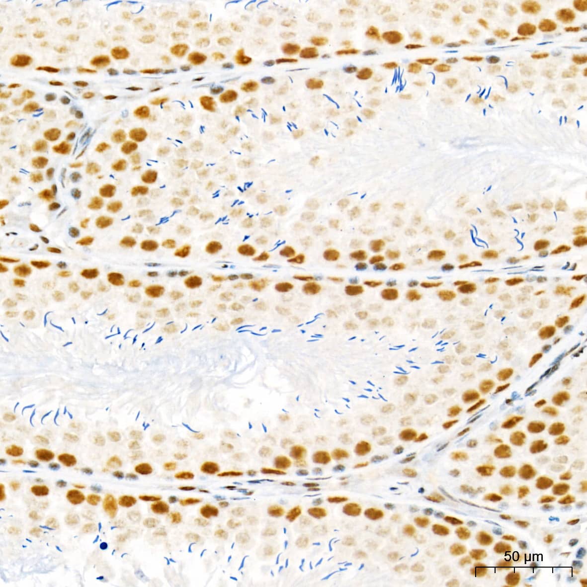 Immunohistochemistry: HYPB Antibody - Azide and BSA Free [HYPB] - Immunohistochemistry analysis of paraffin-embedded Rat testis tissue using HYPB Rabbit pAb  at a dilution of 1:1000 (40x lens). High pressure antigen retrieval performed with 0.01M Citrate Buffer (pH 6.0) prior to IHC staining.