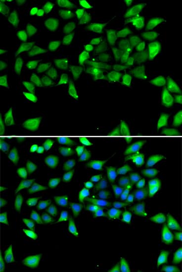 Immunocytochemistry/ Immunofluorescence: EIF3S3 Antibody - BSA Free [NBP3-03812] - Immunofluorescence analysis of U2OS cells using EIF3S3 Rabbit pAb (A13378). Secondary antibody: Cy3-conjugated Goat anti-Rabbit IgG (H+L) (AS007) at 1:500 dilution. Blue: DAPI for nuclear staining.