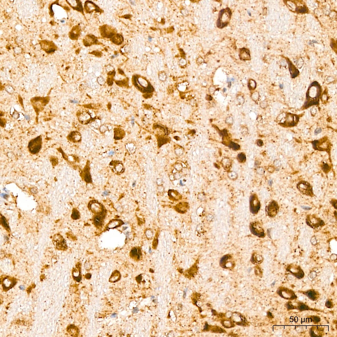 Immunohistochemistry: GFER/ALR Antibody - BSA Free [NBP3-03816] - Immunohistochemistry analysis of GFER/ALR in paraffin-embedded Rat brain tissue using GFER/ALR Rabbit pAb (A5463) at a dilution of  1:400 (40x lens). High pressure antigen retrieval was performed with 0.01 M citrate buffer (pH 6.0) prior to IHC staining.