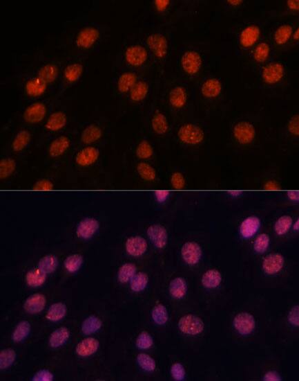 Immunocytochemistry/ Immunofluorescence: Importin-8 Antibody - Azide and BSA Free [NBP3-03821] - Immunofluorescence analysis of C6 cells using Importin-8 Rabbit pAb (A14679) at dilution of 1:100. Secondary antibody: Cy3 Goat Anti-Rabbit IgG (H+L) (AS007) at 1:500 dilution. Blue: DAPI for nuclear staining.