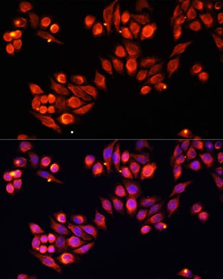 Immunocytochemistry/ Immunofluorescence: Heparanase/HPSE Antibody - Azide and BSA Free [Heparanase/HPSE] - Immunofluorescence analysis of HeLa cells using Heparanase/HPSE Rabbit pAb  at dilution of 1:100. Secondary antibody: Cy3-conjugated Goat anti-Rabbit IgG (H+L)  at 1:500 dilution. Blue: DAPI for nuclear staining.