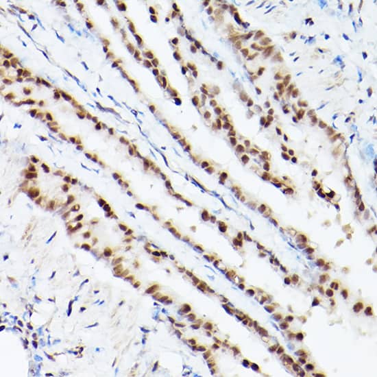 <b>Genetic Strategies Validation. </b>Immunohistochemistry: PA28 Activator gamma Subunit/PSME3 Antibody - Azide and BSA Free [PA28 Activator gamma Subunit/PSME3] - Immunohistochemistry analysis of paraffin-embedded Mouse lung using PA28 Activator gamma Subunit/PSME3 Rabbit pAb  at dilution of 1:100 (40x lens). Microwave antigen retrieval performed with 0.01M PBS Buffer (pH 7.2) prior to IHC staining.