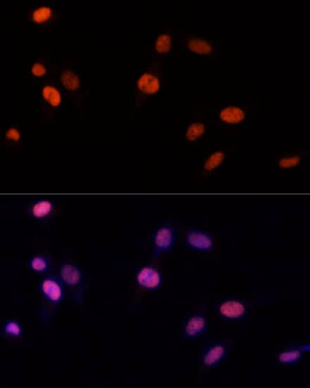 Immunocytochemistry/ Immunofluorescence: PA28 Activator gamma Subunit/PSME3 Antibody - Azide and BSA Free [PA28 Activator gamma Subunit/PSME3] - Immunofluorescence analysis of NIH-3T3 cells using PA28 Activator gamma Subunit/PSME3 Rabbit pAb  at dilution of 1:100 (40x lens). Secondary antibody: Cy3-conjugated Goat anti-Rabbit IgG (H+L)  at 1:500 dilution. Blue: DAPI for nuclear staining.