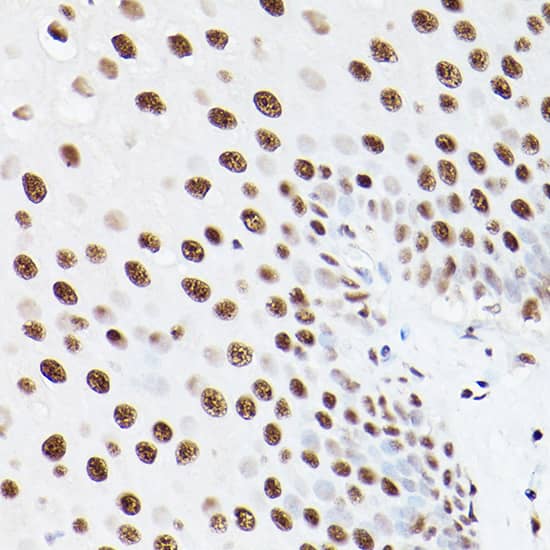 Immunohistochemistry: PA28 Activator gamma Subunit/PSME3 Antibody - Azide and BSA Free [PA28 Activator gamma Subunit/PSME3] - Immunohistochemistry analysis of paraffin-embedded Human esophageal using PA28 Activator gamma Subunit/PSME3 Rabbit pAb  at dilution of 1:100 (40x lens). Microwave antigen retrieval performed with 0.01M PBS Buffer (pH 7.2) prior to IHC staining.