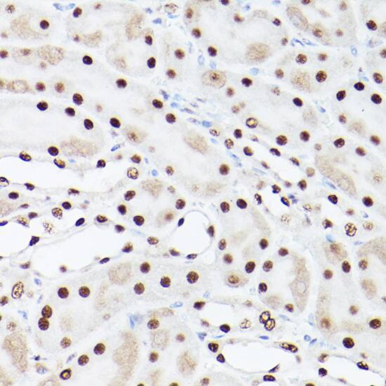 Immunohistochemistry: PA28 Activator gamma Subunit/PSME3 Antibody - Azide and BSA Free [PA28 Activator gamma Subunit/PSME3] - Immunohistochemistry analysis of paraffin-embedded Rat kidney using PA28 Activator gamma Subunit/PSME3 Rabbit pAb  at dilution of 1:100 (40x lens). Microwave antigen retrieval performed with 0.01M PBS Buffer (pH 7.2) prior to IHC staining.