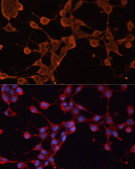 Immunocytochemistry/ Immunofluorescence: ABCB11 Antibody - Azide and BSA Free [NBP3-03893] - Immunofluorescence analysis of NIH/3T3 cells using ABCB11 Rabbit pAb (A14694) at dilution of 1:100. Secondary antibody: Cy3 Goat Anti-Rabbit IgG (H+L) (AS007) at 1:500 dilution. Blue: DAPI for nuclear staining.