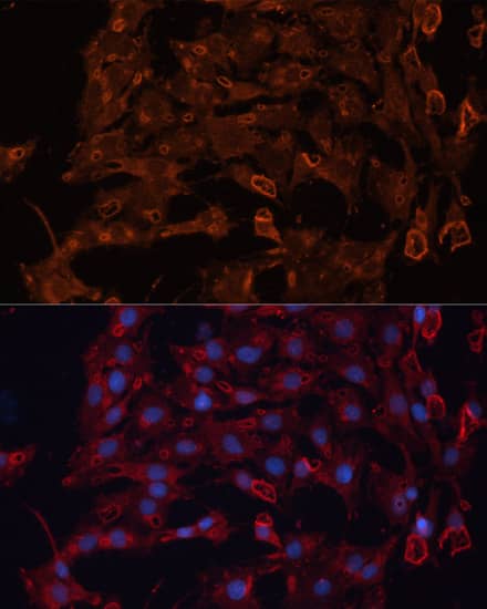 Immunocytochemistry/ Immunofluorescence: ABCB11 Antibody - Azide and BSA Free [NBP3-03893] - Immunofluorescence analysis of C6 cells using ABCB11 Rabbit pAb (A14694) at dilution of 1:100. Secondary antibody: Cy3 Goat Anti-Rabbit IgG (H+L) (AS007) at 1:500 dilution. Blue: DAPI for nuclear staining.