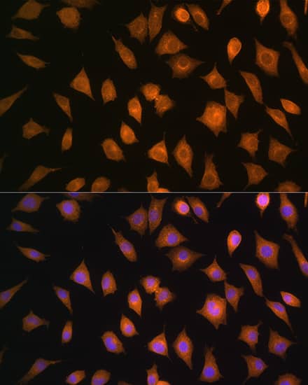 Immunocytochemistry/ Immunofluorescence: ELOVL4 Antibody - Azide and BSA Free [ELOVL4] - Immunofluorescence analysis of L929 cells using ELOVL4 Rabbit pAb  at dilution of 1:100. Secondary antibody: Cy3-conjugated Goat anti-Rabbit IgG (H+L)  at 1:500 dilution. Blue: DAPI for nuclear staining.