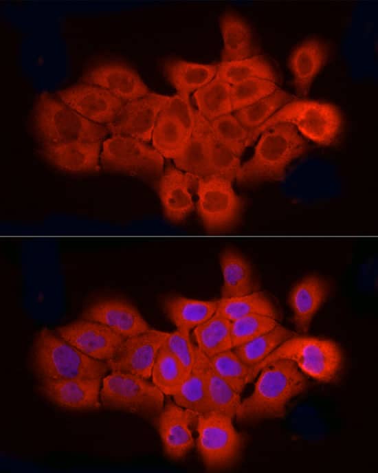 Immunocytochemistry/ Immunofluorescence ELOVL4 Antibody - Azide and BSA Free