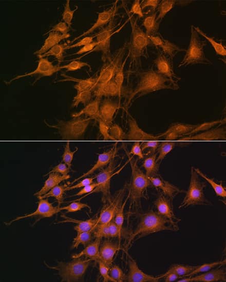 Immunocytochemistry/ Immunofluorescence: ELOVL4 Antibody - Azide and BSA Free [ELOVL4] - Immunofluorescence analysis of C6 cells using ELOVL4 Rabbit pAb  at dilution of 1:100. Secondary antibody: Cy3-conjugated Goat anti-Rabbit IgG (H+L)  at 1:500 dilution. Blue: DAPI for nuclear staining.