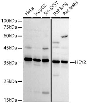 Western Blot HEY2 Antibody - Azide and BSA Free