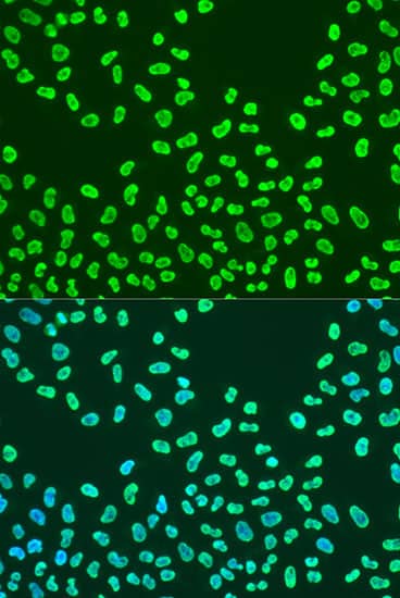 Immunocytochemistry/ Immunofluorescence: KHDRBS2 Antibody - BSA Free [NBP3-03932] - Immunofluorescence analysis of U2OS cells using KHDRBS2 Rabbit pAb (A15969) at dilution of 1:100. Secondary antibody: Cy3 Goat Anti-Rabbit IgG (H+L) (AS007) at 1:500 dilution. Blue: DAPI for nuclear staining.