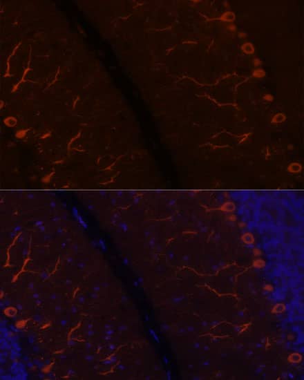 Immunocytochemistry/ Immunofluorescence KAL1 Antibody - Azide and BSA Free