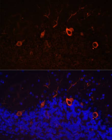 Immunocytochemistry/ Immunofluorescence KAL1 Antibody - Azide and BSA Free