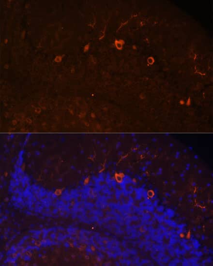 Immunocytochemistry/ Immunofluorescence: KAL1 Antibody - Azide and BSA Free [NBP3-03937] - Immunofluorescence analysis of paraffin-embedded mouse brain using KAL1 Rabbit pAb (A16389) at dilution of 1:100. Secondary antibody: Cy3 Goat Anti-Rabbit IgG (H+L) (AS007) at 1:500 dilution. Blue: DAPI for nuclear staining.