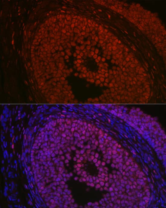 Immunocytochemistry/ Immunofluorescence: FOXL2 Antibody - Azide and BSA Free [NBP3-03941] - Immunofluorescence analysis of rat ovary using FOXL2 Rabbit pAb (A16244) at dilution of 1:100 (40x lens). Blue: DAPI for nuclear staining.