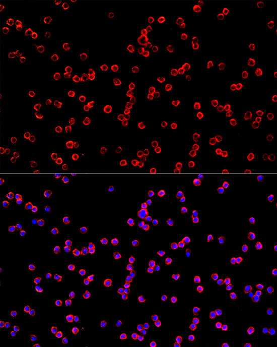 Immunocytochemistry/ Immunofluorescence: USP21 Antibody - Azide and BSA Free [USP21] - Immunofluorescence analysis of RAW264.7 cells using USP21 Rabbit pAb  at dilution of 1:100 (40x lens). Secondary antibody: Cy3-conjugated Goat anti-Rabbit IgG (H+L)  at 1:500 dilution. Blue: DAPI for nuclear staining.