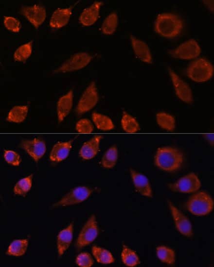 Immunocytochemistry/ Immunofluorescence HPS4 Antibody - Azide and BSA Free