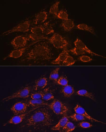 Immunocytochemistry/ Immunofluorescence: HPS4 Antibody - Azide and BSA Free [NBP3-03965] - Immunofluorescence analysis of C6 cells using HPS4 Rabbit pAb (A16157) at dilution of 1:100. Secondary antibody: Cy3 Goat Anti-Rabbit IgG (H+L) (AS007) at 1:500 dilution. Blue: DAPI for nuclear staining.