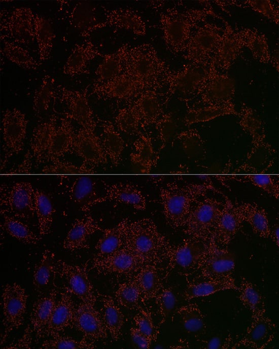 Immunocytochemistry/ Immunofluorescence: GLS2 Antibody - Azide and BSA Free [NBP3-04094] - Immunofluorescence analysis of U2OS cells using GLS2 Rabbit pAb (A16029) at dilution of 1:200 (40x lens). Blue: DAPI for nuclear staining.