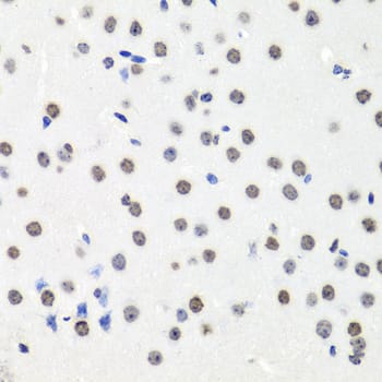 Immunohistochemistry: Histone H2AX Antibody - BSA Free [Histone H2AX] - Immunohistochemistry analysis of paraffin-embedded Mouse brain using Histone H2AX Rabbit pAb  at dilution of 1:100 (40x lens). Microwave antigen retrieval performed with 0.01M PBS Buffer (pH 7.2) prior to IHC staining.