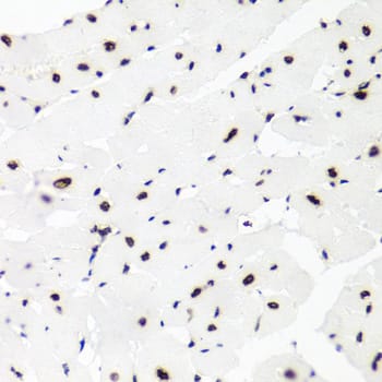 Immunohistochemistry: Histone H2AX Antibody - BSA Free [Histone H2AX] - Immunohistochemistry analysis of paraffin-embedded Rat heart using Histone H2AX Rabbit pAb  at dilution of 1:100 (40x lens). Microwave antigen retrieval performed with 0.01M PBS Buffer (pH 7.2) prior to IHC staining.