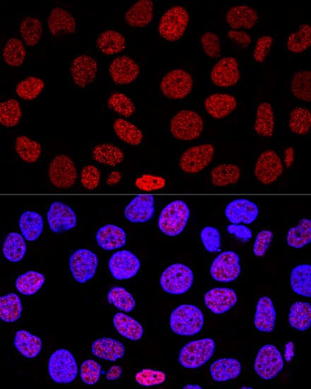 Immunocytochemistry/ Immunofluorescence: Histone H2AX Antibody - BSA Free [Histone H2AX] - Confocal immunofluorescence analysis of HeLa cells using Histone H2AX Rabbit pAb  at dilution of 1:200. Blue: DAPI for nuclear staining.