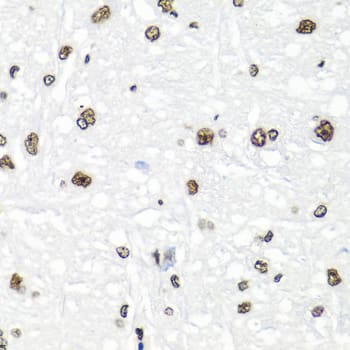 Immunohistochemistry: Histone H2AX Antibody - BSA Free [Histone H2AX] - Immunohistochemistry analysis of paraffin-embedded Rat brain using Histone H2AX Rabbit pAb  at dilution of 1:100 (40x lens). Microwave antigen retrieval performed with 0.01M PBS Buffer (pH 7.2) prior to IHC staining.