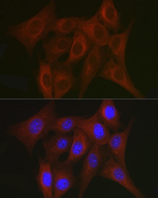 Immunocytochemistry/ Immunofluorescence: TRAF7 Antibody - Azide and BSA Free [TRAF7] - Immunofluorescence analysis of NIH/3T3 cells using TRAF7 Rabbit pAb  at dilution of 1:50. Secondary antibody: Cy3 Goat Anti-Rabbit IgG (H+L)  at 1:500 dilution. Blue: DAPI for nuclear staining.