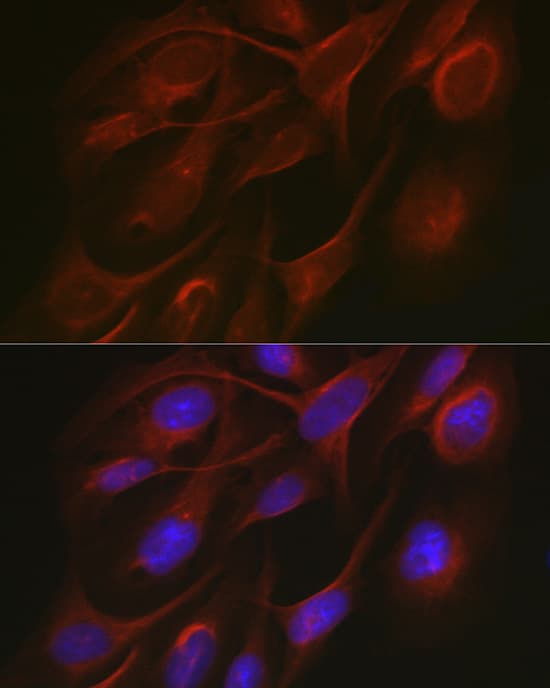 Immunocytochemistry/ Immunofluorescence: TRAF7 Antibody - Azide and BSA Free [TRAF7] - Immunofluorescence analysis of U2OS cells using TRAF7 Rabbit pAb  at dilution of 1:50. Secondary antibody: Cy3 Goat Anti-Rabbit IgG (H+L)  at 1:500 dilution. Blue: DAPI for nuclear staining.