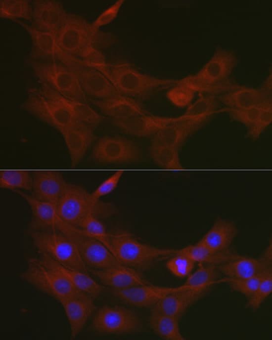 Immunocytochemistry/ Immunofluorescence: TRAF7 Antibody - Azide and BSA Free [TRAF7] - Immunofluorescence analysis of PC-12 cells using TRAF7 Rabbit pAb  at dilution of 1:50. Secondary antibody: Cy3 Goat Anti-Rabbit IgG (H+L)  at 1:500 dilution. Blue: DAPI for nuclear staining.