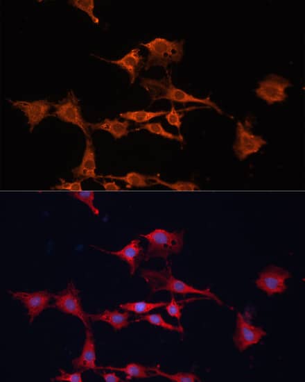 Immunocytochemistry/ Immunofluorescence GSTM3 Antibody - Azide and BSA Free