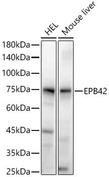 Western Blot: EPB42 Antibody - Azide and BSA Free [EPB42] - Western blot analysis of various lysates, using EPB42 Rabbit pAb  at  1:800 dilution.Secondary antibody: HRP-conjugated Goat anti-Rabbit IgG (H+L)  at 1:10000 dilution.Lysates/proteins: 25ug per lane.Blocking buffer: 3% nonfat dry milk in TBST.Detection: ECL Basic Kit .Exposure time: 45s.