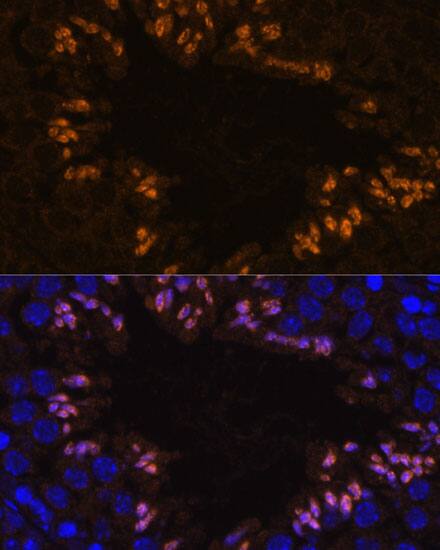 Immunocytochemistry/ Immunofluorescence: ELSPBP1 Antibody - Azide and BSA Free [NBP3-04400] - Immunofluorescence analysis of paraffin-embedded mouse testis using ELSPBP1 Rabbit pAb (A15882) at dilution of 1:100. Secondary antibody: Cy3 Goat Anti-Rabbit IgG (H+L) (AS007) at 1:500 dilution. Blue: DAPI for nuclear staining.