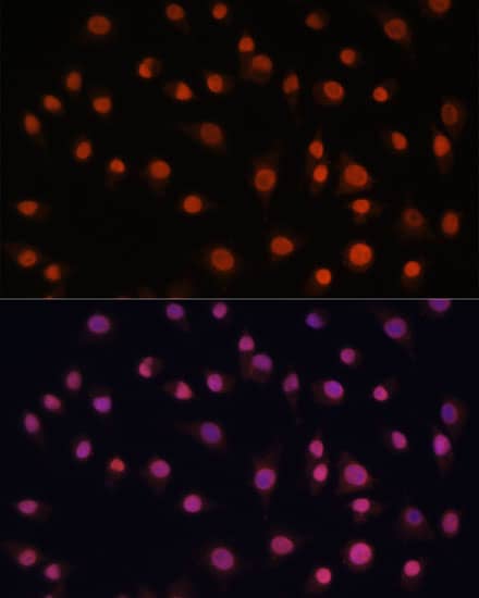 Immunocytochemistry/ Immunofluorescence: H2AFV Antibody - Azide and BSA Free [H2AFV] - Immunofluorescence analysis of L929 cells using H2AFV Rabbit pAb  at dilution of 1:100. Secondary antibody: Cy3 Goat Anti-Rabbit IgG (H+L)  at 1:500 dilution. Blue: DAPI for nuclear staining.