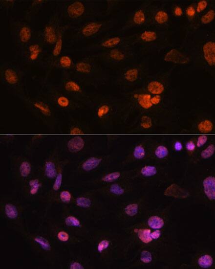 Immunocytochemistry/ Immunofluorescence: H2AFV Antibody - Azide and BSA Free [H2AFV] - Immunofluorescence analysis of C6 cells using H2AFV Rabbit pAb  at dilution of 1:100. Secondary antibody: Cy3 Goat Anti-Rabbit IgG (H+L)  at 1:500 dilution. Blue: DAPI for nuclear staining.